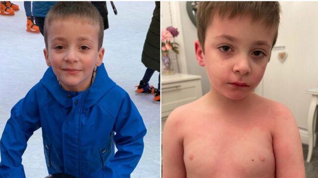 600ab7152500000a0fe236dd