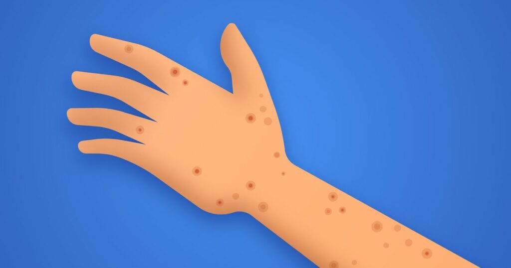 630f82382000003300d9cc4c